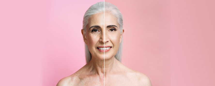 Anti-ageing treatment