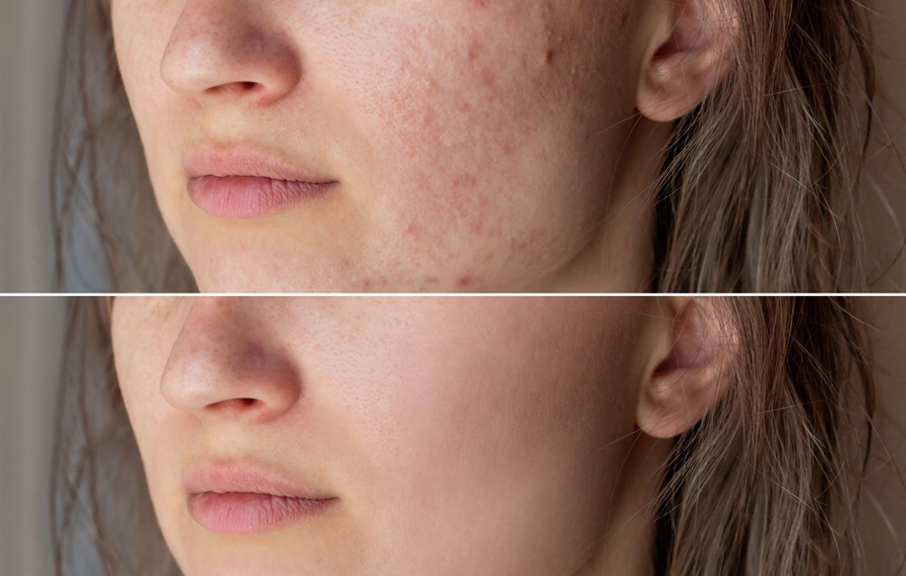 best skin infection doctor in zirakpur